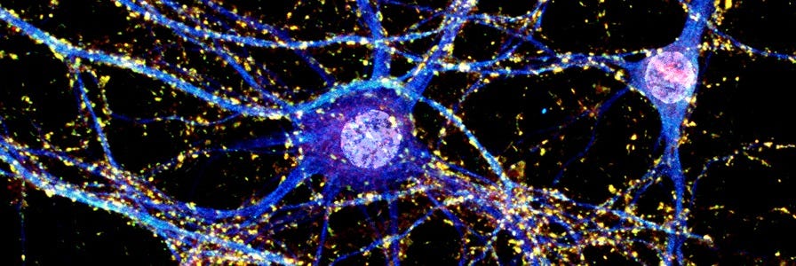 neuron_image