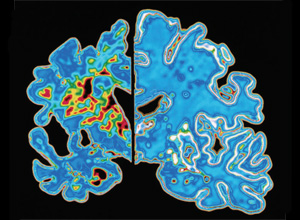 cover-image