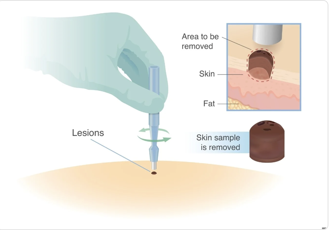 Fig. 2 — Biopsy punch mechanism adapted for automated gel band excision