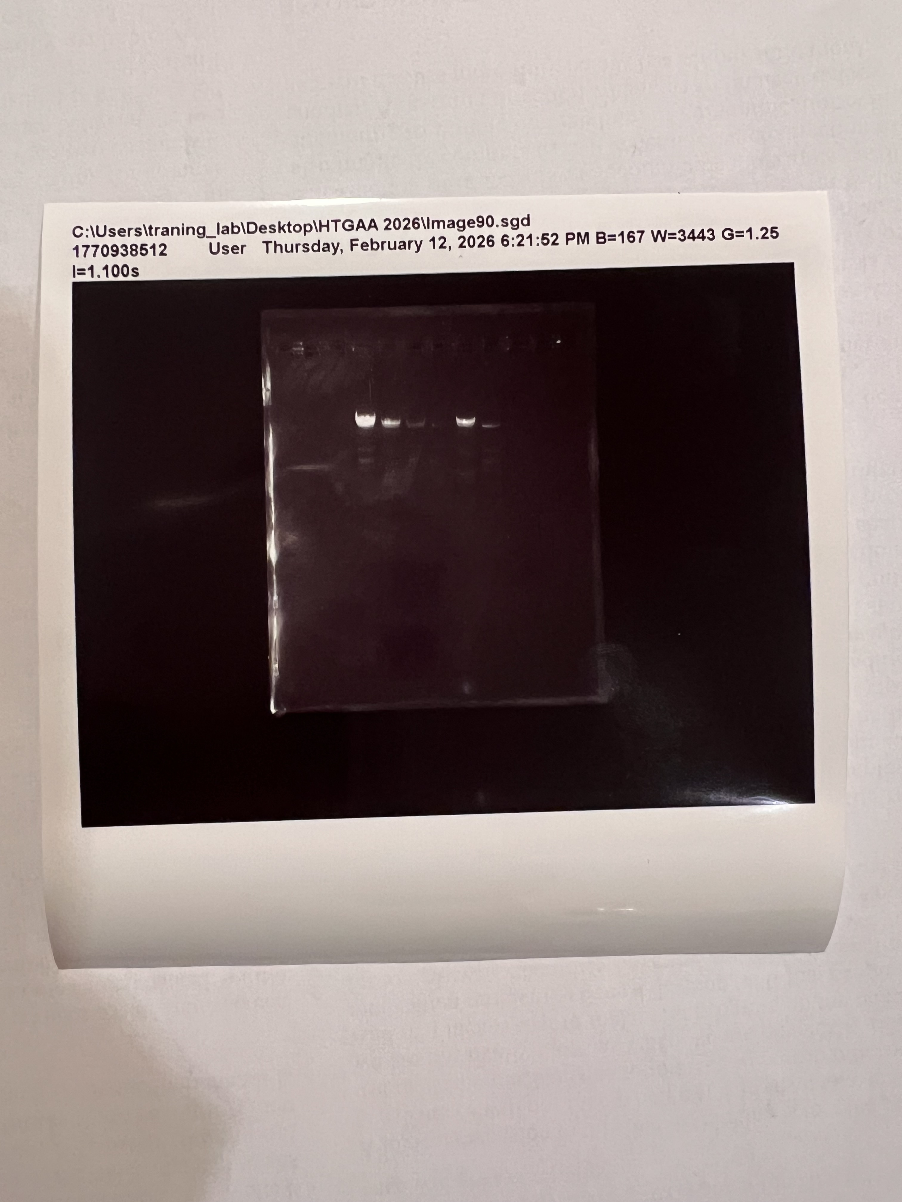 Gel result — printed from imager